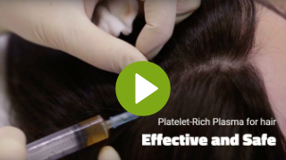 Pleatelet Rich Plasma for Hair