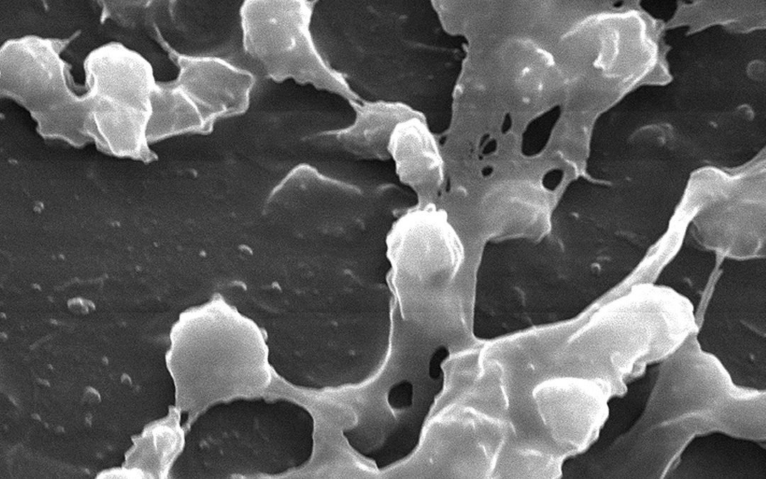 Biofilms and chronic illness